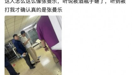 马思纯男友张曼乐现身医院急诊就医 疑似被人用酒瓶砸伤